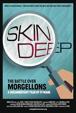 LugaTv | Watch Skin Deep The Battle Over Morgellons for free online